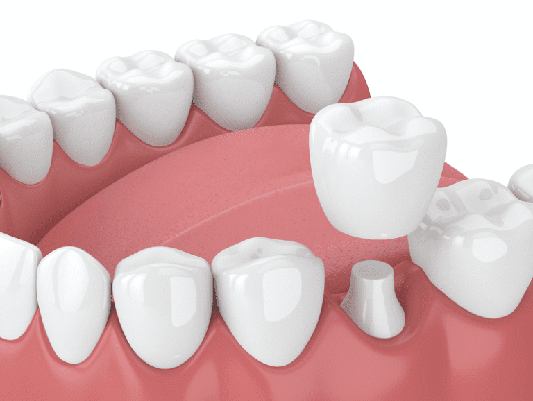 Mass Dental Associates Mass Dental Associates