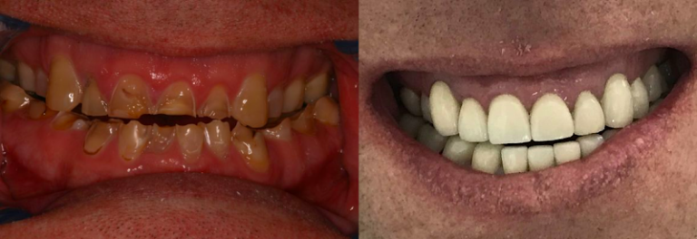 Advanced Dentistry of Connecticut Advanced Dentistry of Connecticut