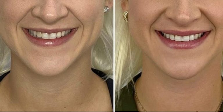 California Dental Design California Dental Design