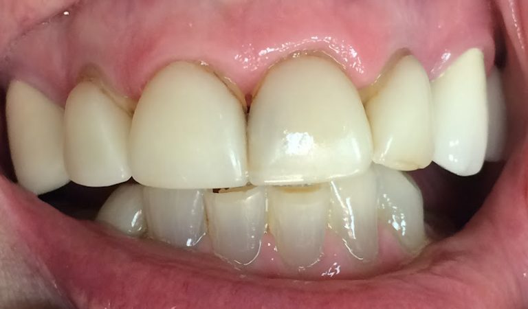 Double Diamond Dental: Michael A Morgan DDS Double Diamond Dental: Michael A Morgan DDS