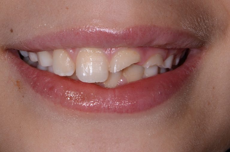 Guaranteed Smiles and Designer Smiles of Colorado Guaranteed Smiles and Designer Smiles of Colorado
