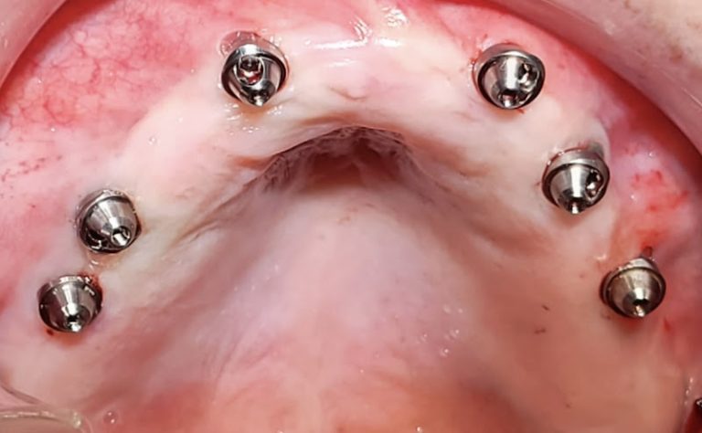 LC Quality Dental LC Quality Dental