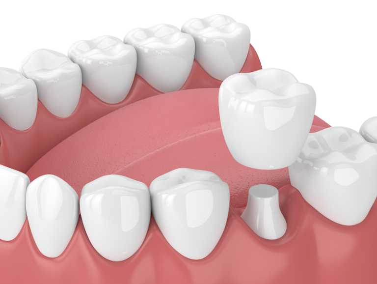 Mass Dental Associates Mass Dental Associates