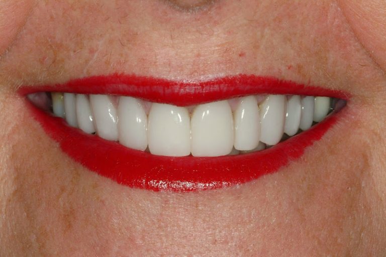 Meadowlark Dental Associates - Kearney, NE Meadowlark Dental Associates - Kearney, NE