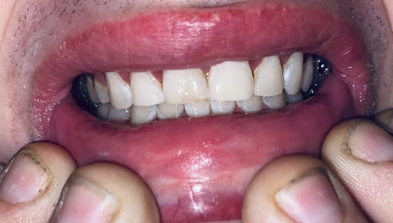 Open and Affordable Dental Cherry Creek Open and Affordable Dental Cherry Creek