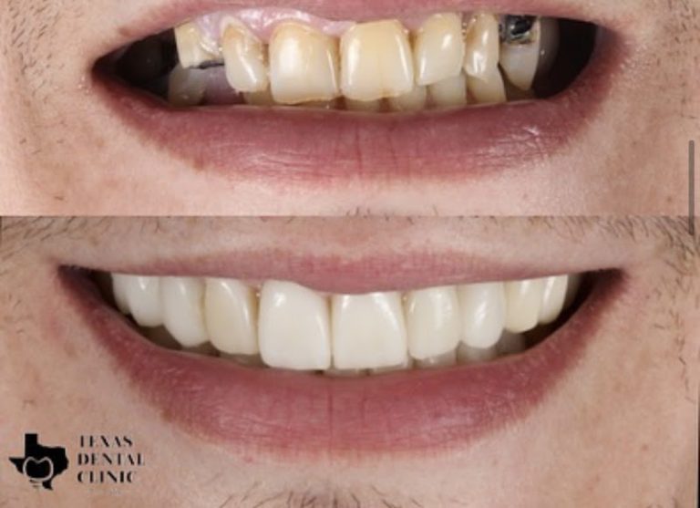 Texas Dental Clinic - implant & cosmetic dentistry Texas Dental Clinic - implant & cosmetic dentistry