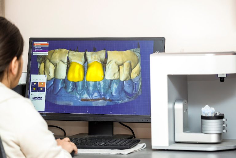 Arizona 3D Dental Lab, LLC - Dental implants provider At 11851 N 51st Ave Ste C110, Glendale, AZ 11851 1 photo 09765305 ee80 46c1 8bca 5fad31c79025 768x513