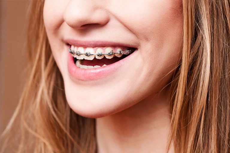 NEW YORK DENTAL SPECIALTY GROUP - Dentist At 180 West End Ave Suite 1F, New York, NY 10023 2 photo 0c300760 4302 42d9 b579 ccd7b96c7f71 768x512
