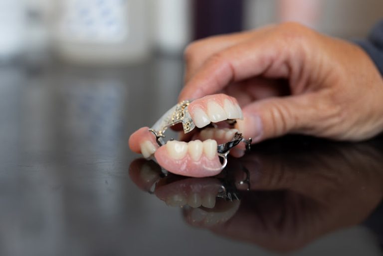 Apex Dental - Dentist At 725 S 51st St, West Des Moines, IA 50265 2 photo 1612701e 7082 4174 b2d2 47a1caa0ce60 768x513