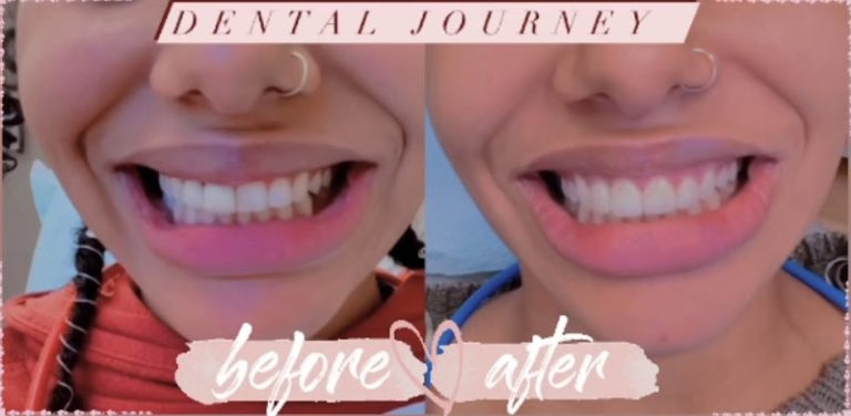 Sunrise Family Dental Care - Dentist At 160 Robbins St, Waterbury, CT 06708 2 photo 1ec95e55 7e5c 4278 a3fa 12e830fb4139 768x376