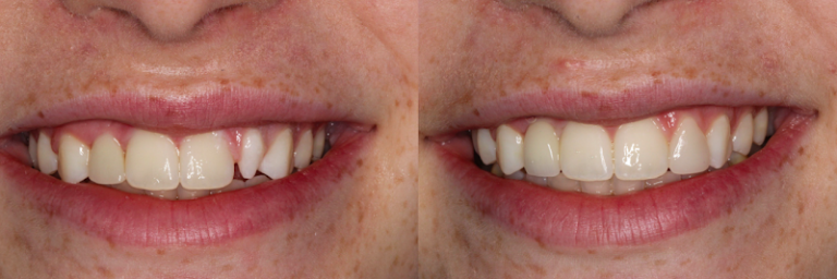 Cosmetic and Implant Dentistry of Connecticut - Dentist At 1240 Whitney Ave, Hamden, CT 06517 6 photo 278063e8 39b7 4c4c beb3 e44e3906ebf3 768x256