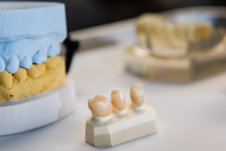 West Lake Dental Center - Dentist At 3033 Excelsior Blvd UNIT 310, Minneapolis, MN 55416 2 photo 30db7372 35cd 4183 b6e0 a5ee8db42397 768x513