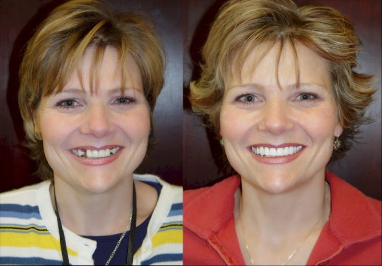 Intermountain Smiles - Dentist At 10011 Centennial Pkwy Suite 525, Sandy, UT 10011 3 photo 357eb265 d07f 4112 8a7f edc39daf7063 768x535