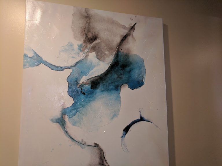 Dental Care Olathe - Dentist At 1717 S Mur-Len Rd, Olathe, KS 66062 3 photo 371ba90f d529 4d0d 8214 7fab1ebcf17a 768x576