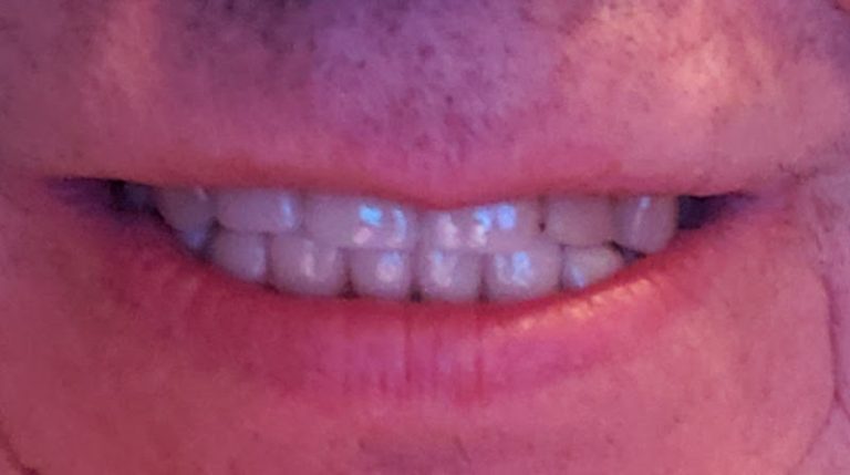 Dr. Randy Halihan Family Dentistry - Dentist At 149 N Virginia St #100, Crystal Lake, IL 60014 3 photo 48515886 29b9 4488 a74a 8e6613571a04 768x429