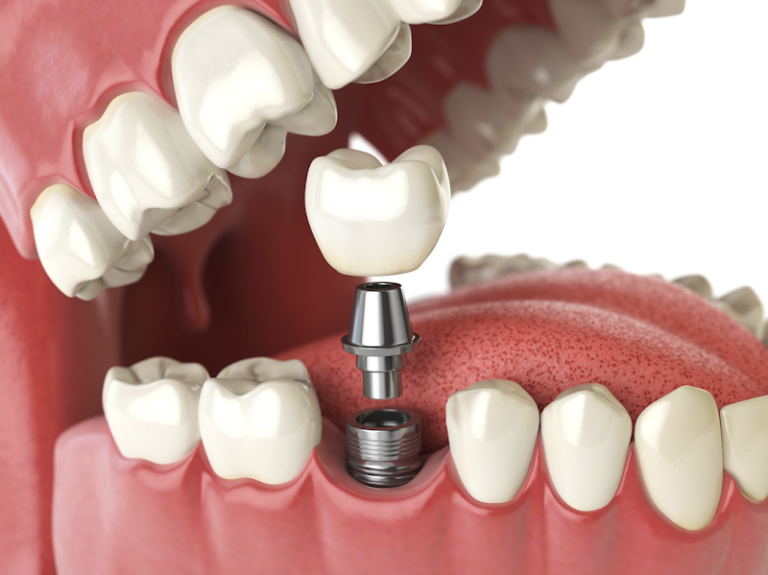 Mass Dental Associates - Dentist At 770 Tremont St, Boston, MA 02118 2 photo 4bc327cc cf02 4b03 b304 d241a9ac9ad9 768x575