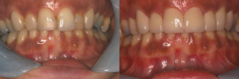 Advanced Dentistry of Connecticut - Dentist At 2318 Main St, Stratford, CT 06615 4 photo 696ff919 7211 4543 b071 46351a6c2a66 768x255