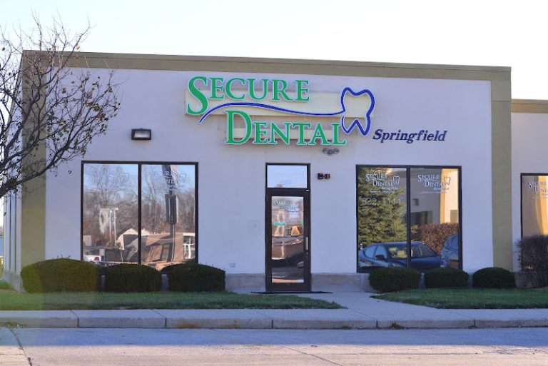 Secure Dental - Springfield - Dentist At 687 E Linton Ave, Springfield, IL 62703 3 photo 6a7f42fe 91bf 42b6 860d a6edcbe06297 768x513