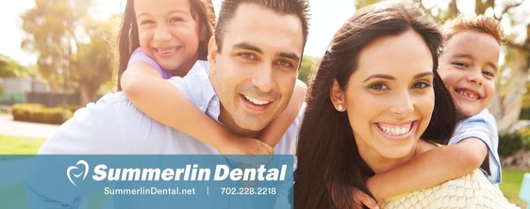 Summerlin Dental - Dentist At 410 S Rampart Blvd Suite #360, Las Vegas, NV 89145 2 photo 87a68fbe 1351 4bff ae3e b55197040d98 768x303