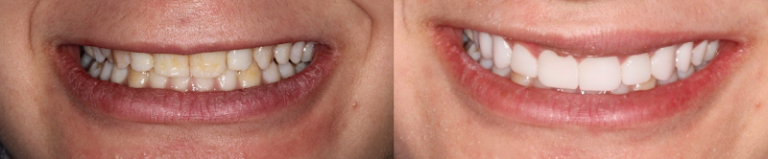 Cosmetic and Implant Dentistry of Connecticut - Dentist At 1240 Whitney Ave, Hamden, CT 06517 5 photo 8a9229fa bb6d 4881 80a0 43d2be8bf1e2 768x159