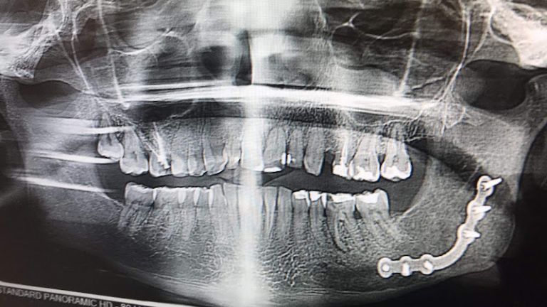 Milwaukee Dental Group - Dentist At 5542 W Fond Du Lac Ave, Milwaukee, WI 53216 2 photo 91a1769c 322a 471d a57d defa7b9bd211 768x432