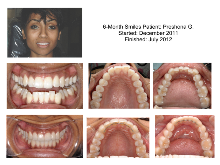 Howard County Family Dentistry - Dentist At 12800 Frederick Rd, West Friendship, MD 12800 4 photo 923641d8 441d 457a 9cd6 a114a05bc887 768x576