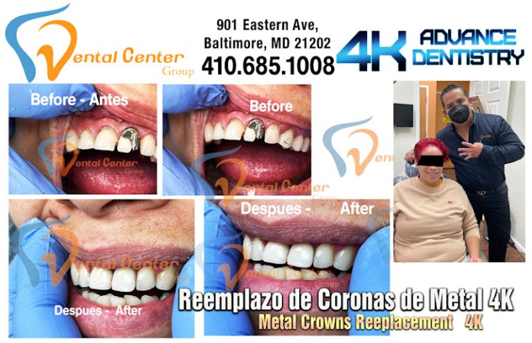 Dental Center Group - Dentist At 901 Eastern Ave, Baltimore, MD 21202 2 photo 92d17e82 387f 4a5b 8754 e14ed65e8aae 768x496
