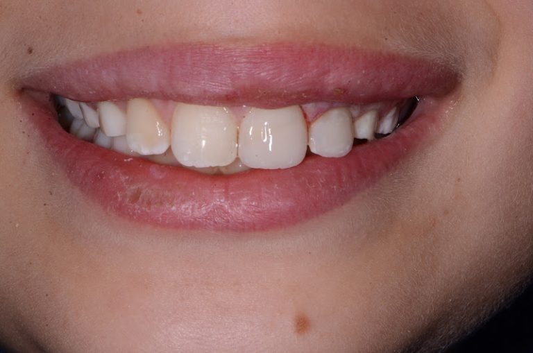 Guaranteed Smiles and Designer Smiles of Colorado - Dentist At 26 W Dry Creek Cir #310, Littleton, CO 80120 3 photo 96d6b401 9a48 45aa 84fd 65a56e52369a 768x509