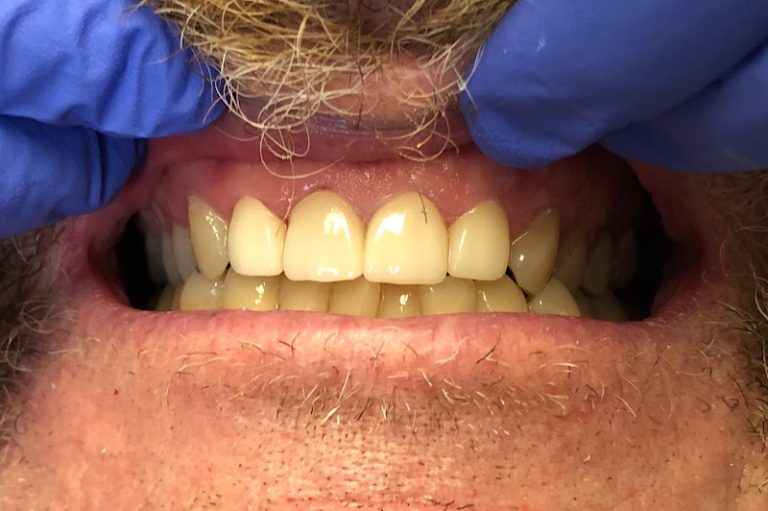 East Pershing Dental - Dentist At 1200 E Pershing Blvd, Cheyenne, WY 82001 2 photo 9ca1b223 80eb 46dd be52 f87639be7f75 768x511