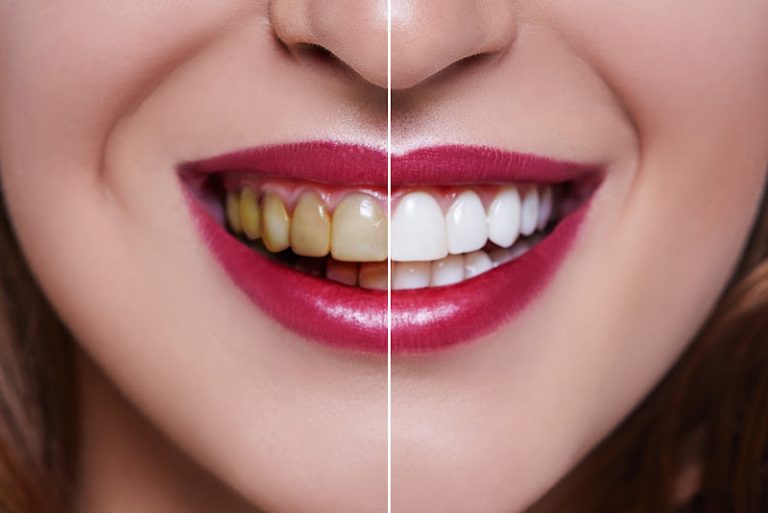 Sun Dental - Dentist At 224 NJ-37, Toms River, NJ 08753 4 photo ad564004 fb8e 4538 89bf 26bef65590d3 768x513