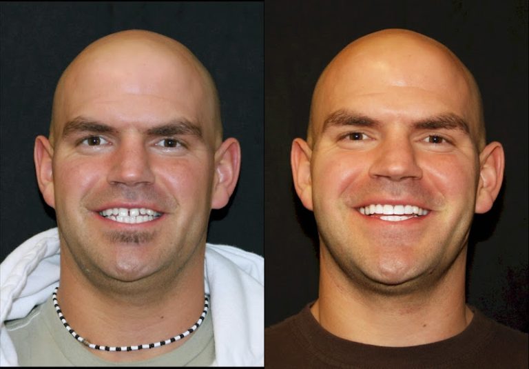 Intermountain Smiles - Dentist At 10011 Centennial Pkwy Suite 525, Sandy, UT 10011 4 photo b13005fa 5fde 4048 b3b9 6675cf4f4751 768x535