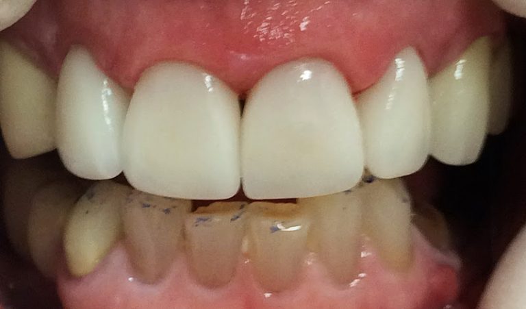 Double Diamond Dental: Michael A Morgan DDS - Dentist At 9492 Double R Blvd STE A, Reno, NV 89521 3 photo ba4ab14c f5c1 411c b2cb 1a095928d42a 768x451