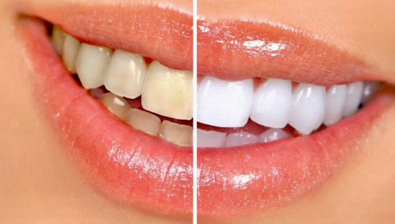 Connecticut Dental Group- M. Azar DDS - Dentist At 4699 Main St Suite 203, Bridgeport, CT 06606 2 photo c743ea7c 3d41 4136 bf77 3fee6b63c216 768x436