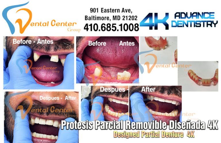 Dental Center Group - Dentist At 901 Eastern Ave, Baltimore, MD 21202 3 photo dfcc3f19 55c1 4508 9854 fd00ca147397 768x496