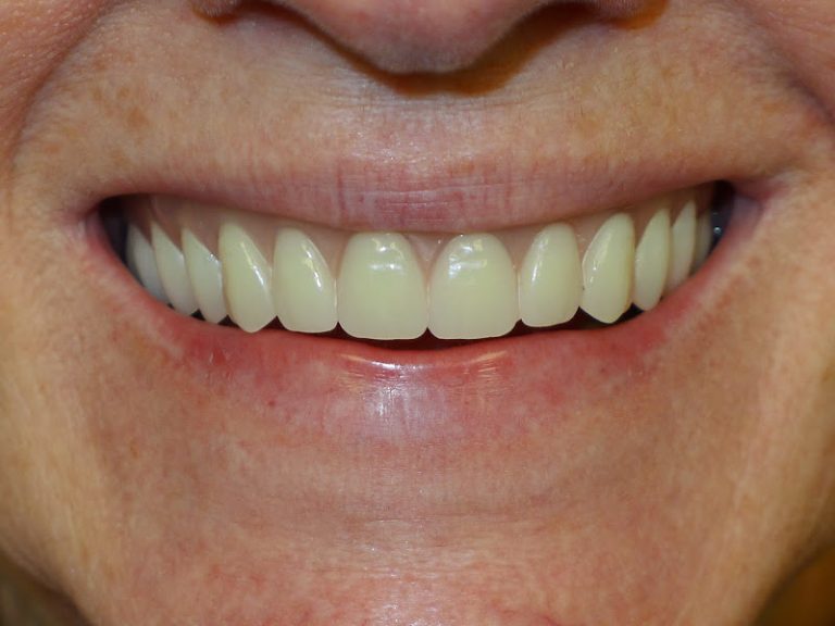 Evergreen Dental Care - Dentist At 101 Shattuck Way STE 5, Newington, NH 03801 4 photo e09edfe8 e68f 44c4 9928 c3c1934aa129 768x576