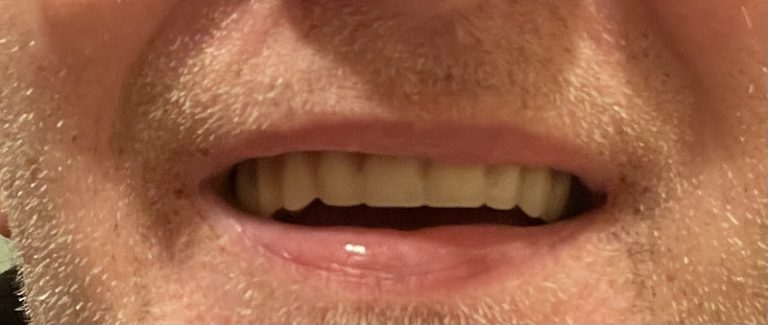 Penns Valley Dental Associates - Dentist At 4570 Penns Valley Rd, Spring Mills, PA 16875 2 photo e9dfee02 1297 44a8 8233 786b9fcbeb6d 768x325