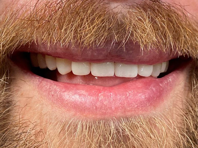 Avenues Dentistry Salt Lake City - Dentist At 215 S 1000 E, Salt Lake City, UT 84102 2 photo ea0c2ada 33d0 4717 93b5 5371d6ccaa09 768x576