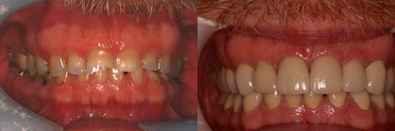 Advanced Dentistry of Connecticut - Dentist At 2318 Main St, Stratford, CT 06615 3 photo ec42488d 4f4f 48ec 9826 b28c001872ea 768x256