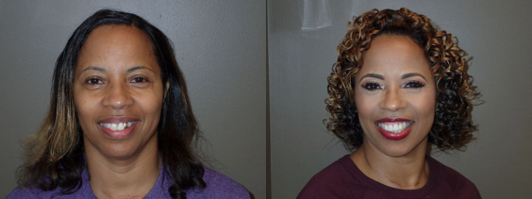 Batesville Dentistry - Dentist At 310 US-51 S, Batesville, MS 38606 4 photo ed93089f 46b1 48f6 a1b4 74246e23d344 768x288