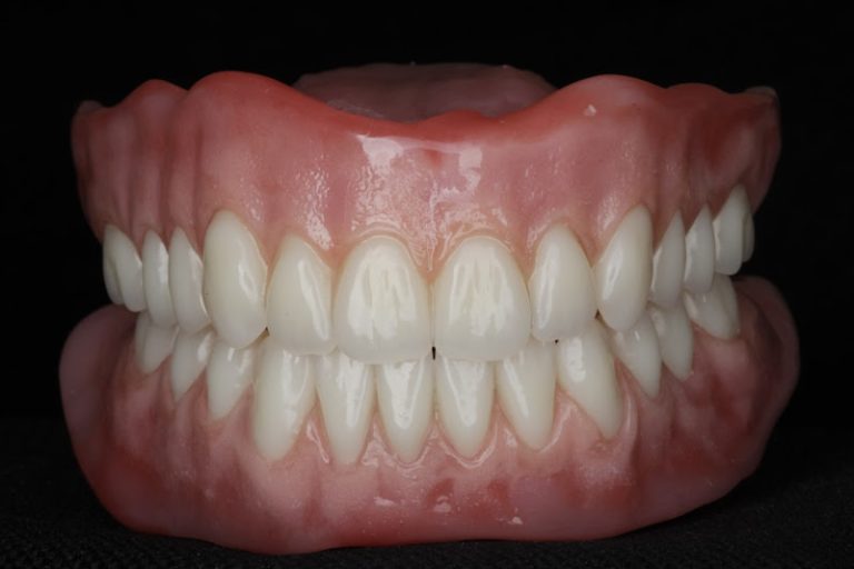 Middle Tennessee Prosthodontics - Cosmetic dentist At 1177 Old Hickory Blvd Ste 102, Brentwood, TN 37027 5 photo f204642b f83d 4e2d 9910 fb28d46117ea 768x512