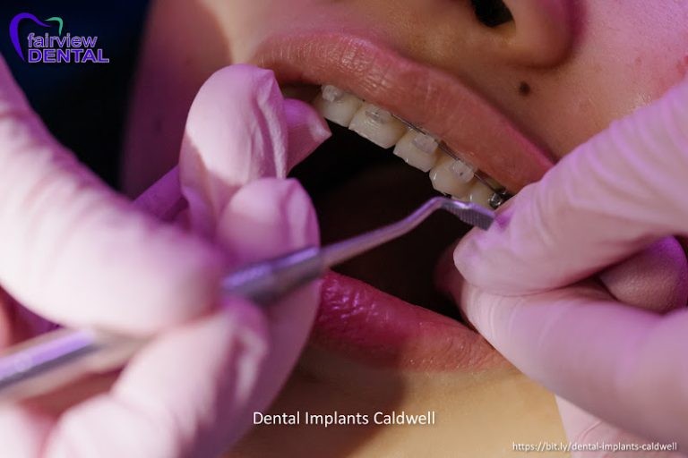 Fairview Dental - Dentist At 329 E Logan St, Caldwell, ID 83605 4 photo f4403ef0 1a2b 4a09 89d0 11bad7b97533 768x512