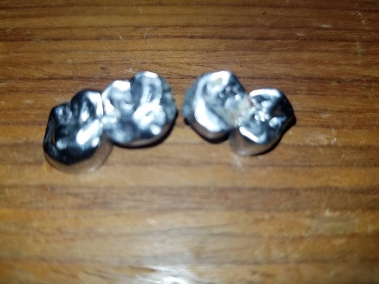 Dr. Charlie Ilawan, DDS - Dentist At 400 Myrtle Dr, Covington, LA 70433 2 photo fb5df97a 4f16 495e 96f0 e4f6146db3c4 768x576