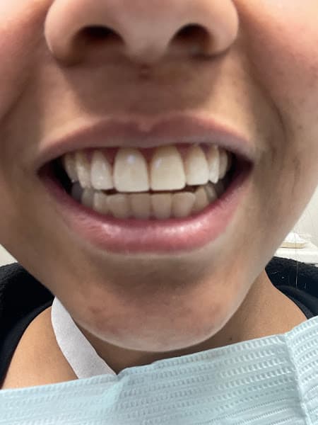 Absolute Dental - Aliante
