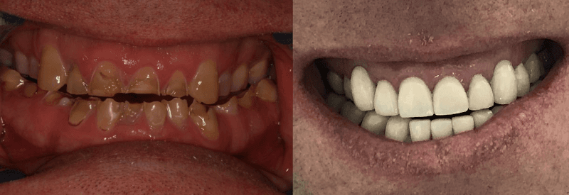 Advanced Dentistry of Connecticut