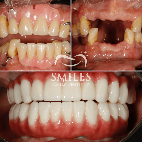 Brunswick Smiles Family Dentistry