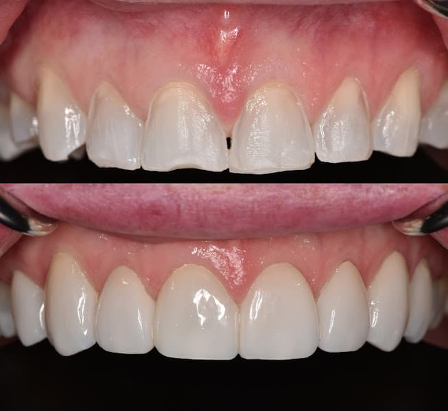 Carson Valley Dental Arts