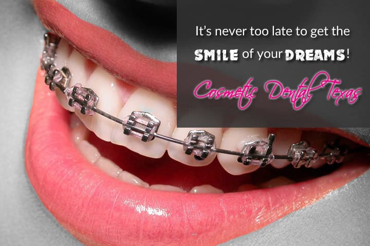 Cosmetic Dental Texas