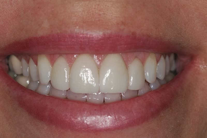 Dental Care Associates: Nathan Deeter DDS