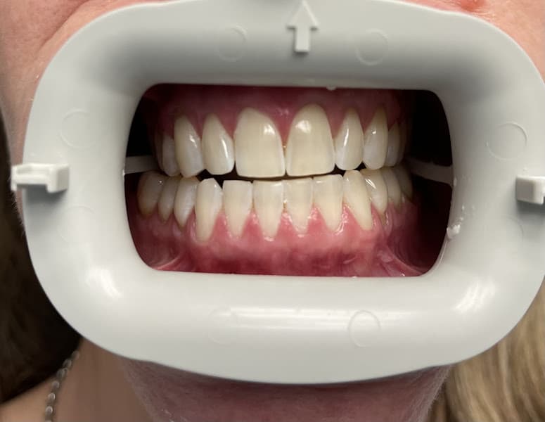 Dentistry of Poulsbo