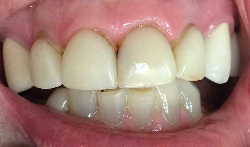 Double Diamond Dental: Michael A Morgan DDS